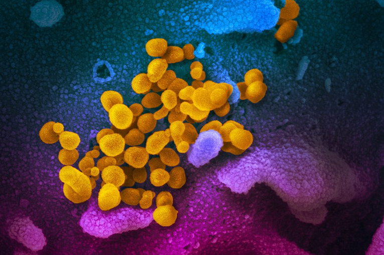 Coronavirus