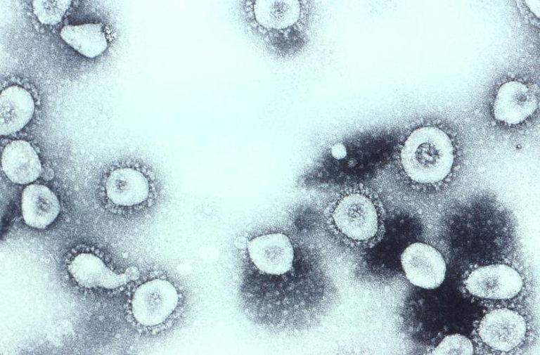 coronavirus
