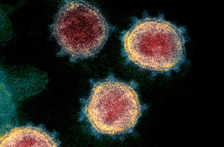 virus