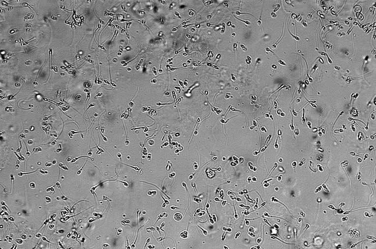 sperm cells
