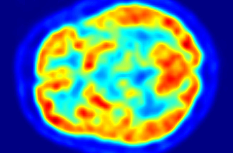 human brain image