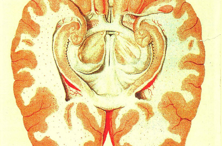 drawing of brain
